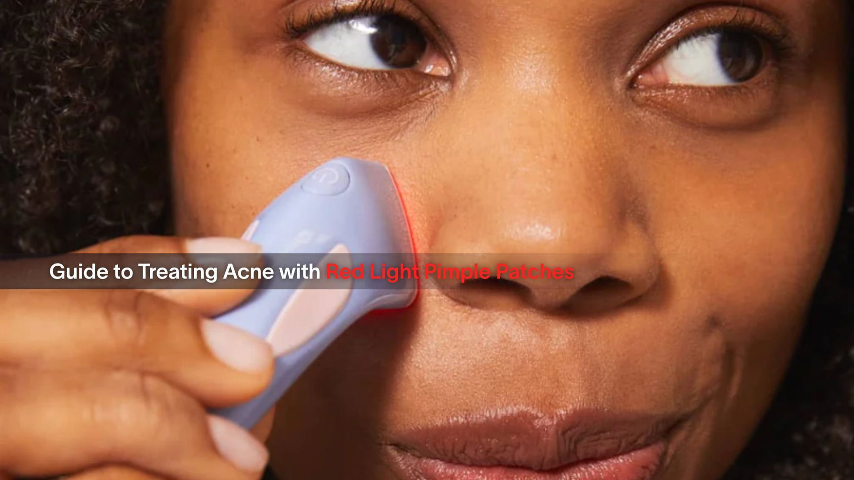 Guide to Treating Acne with Red Light Pimple Patches