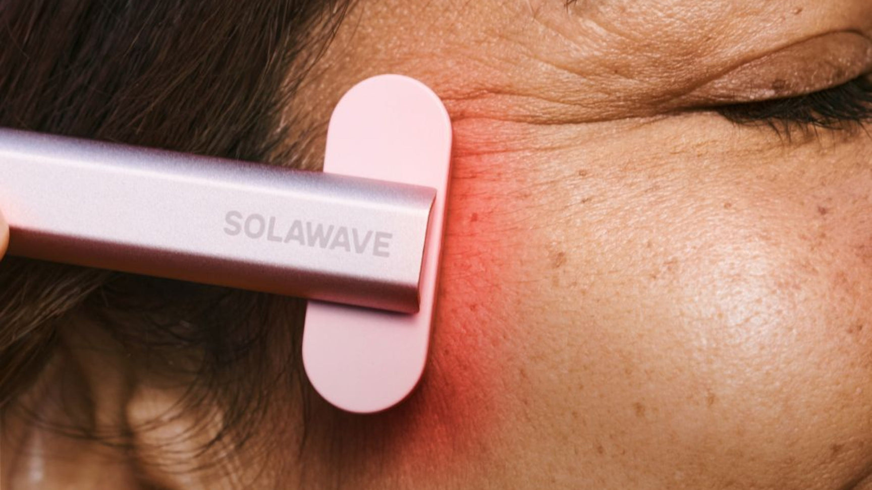 Ingredients That Will Keep Back Acne at Bay