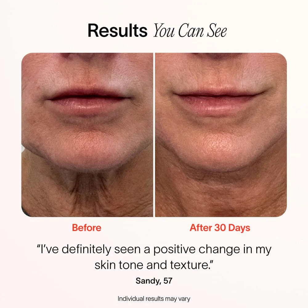 A before and after comparison showing the results from red light therapy done on the chin area