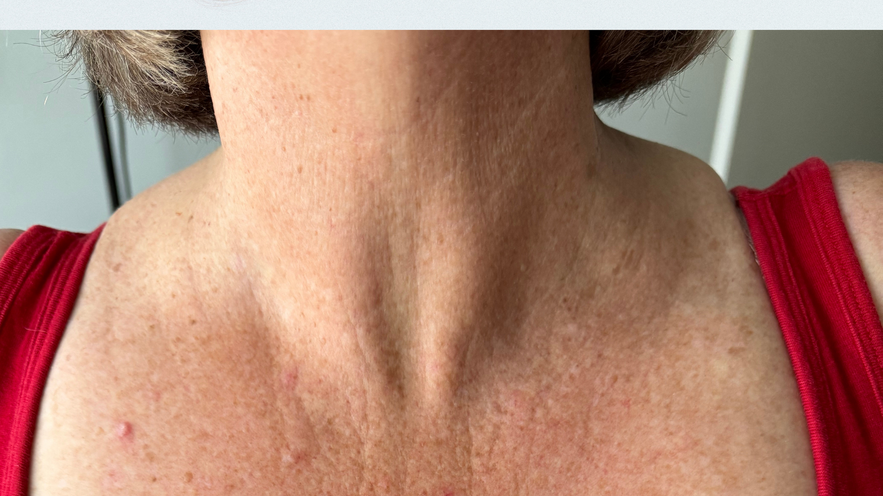 A woman with saggy neck skin