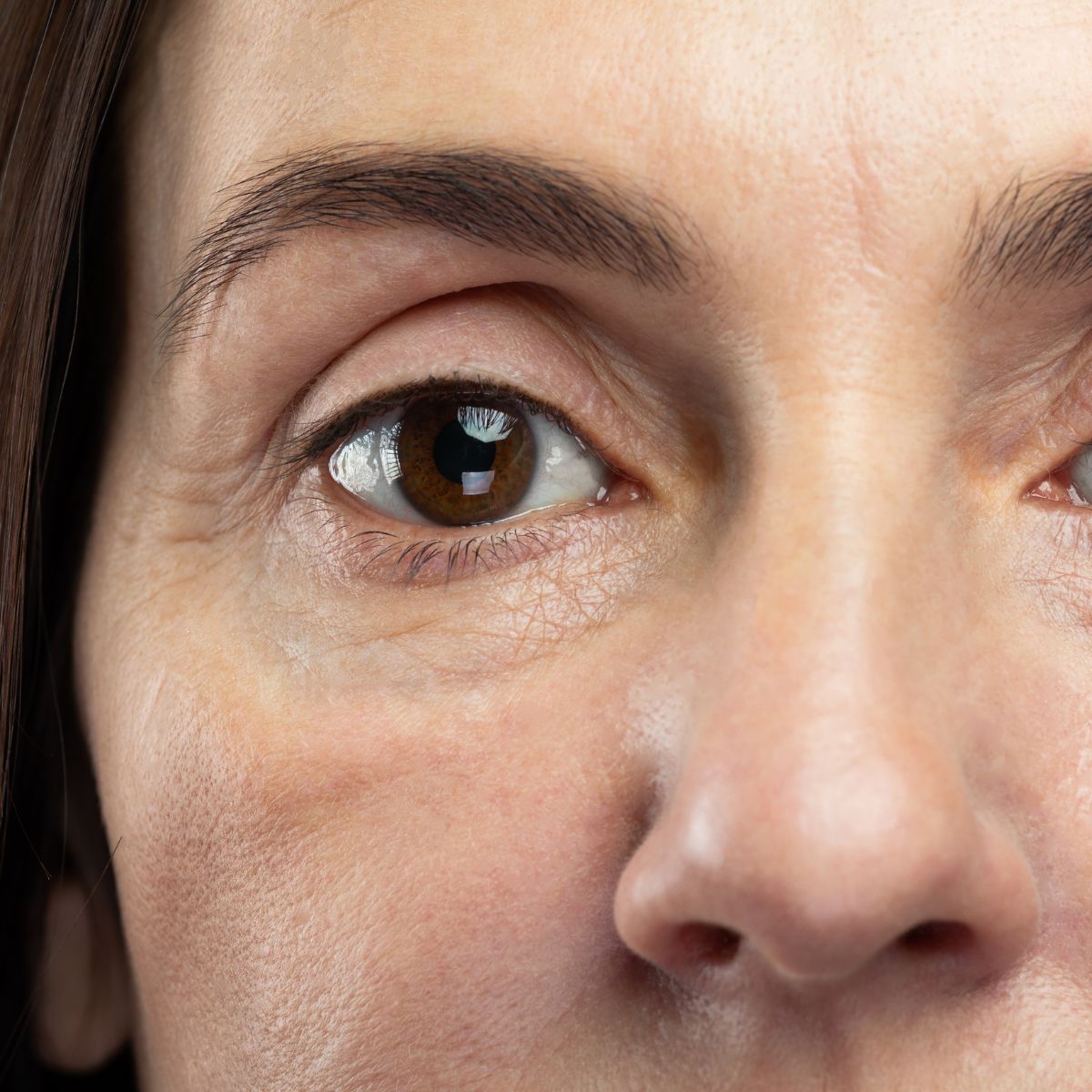 An image of a woman with dull skin