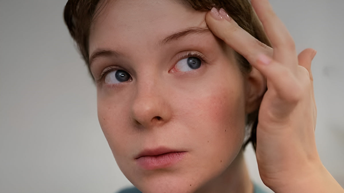 Dark Spots Treatment at Home