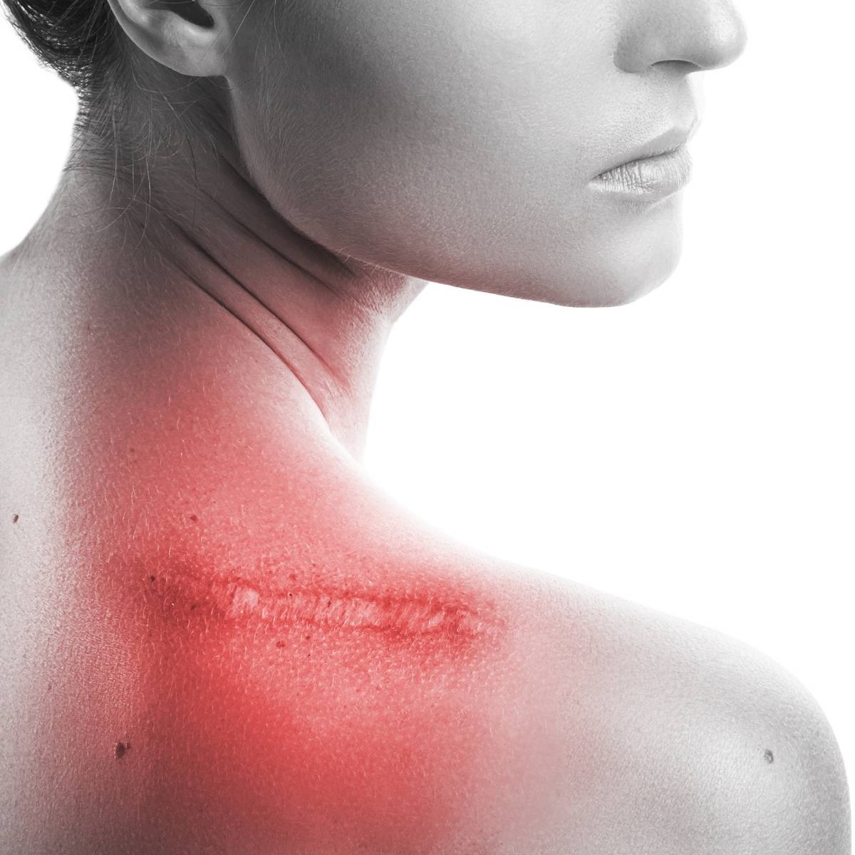 An image of a person with red light on their shoulder 