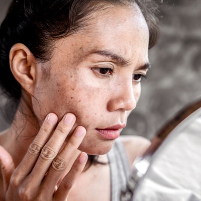 Blemishes FAQ