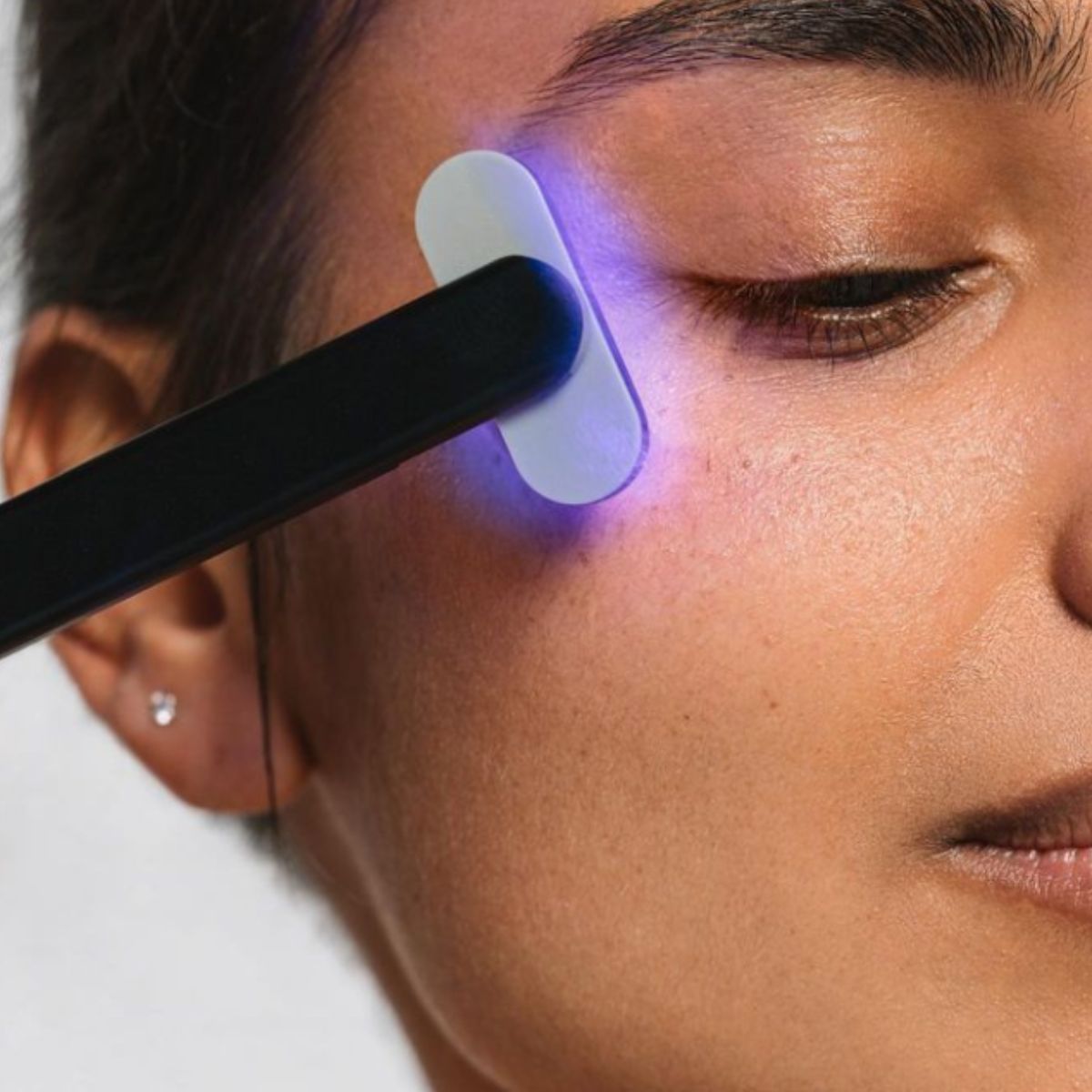 An image of a lady using a blue light therapy device on her face