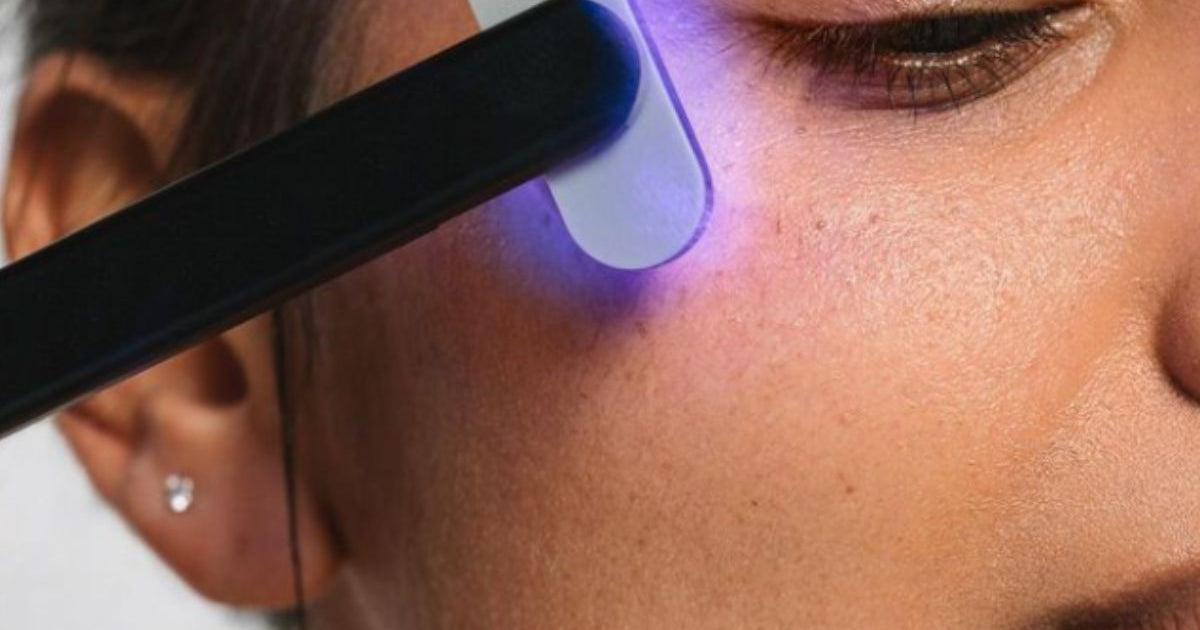 Why Blue Light Therapy for Pimples Simply Works | Solawave