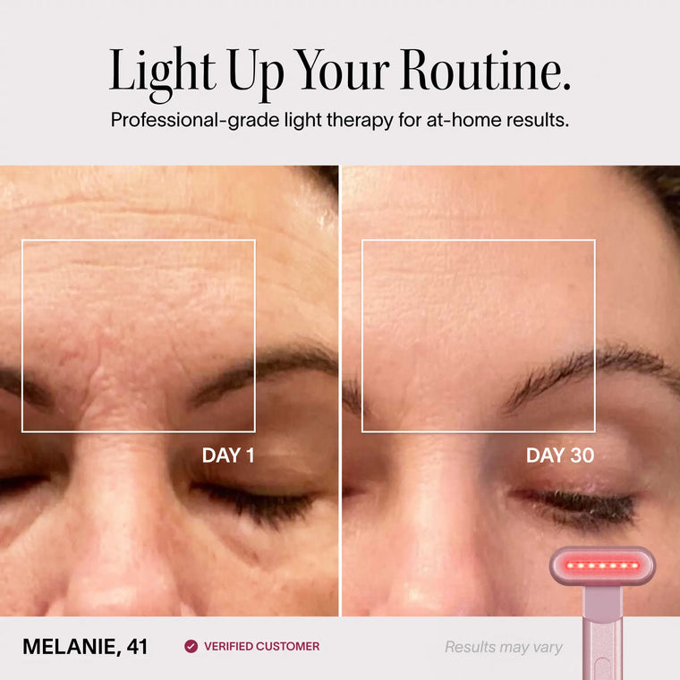 All The Light Therapy You Need VIP Bundle