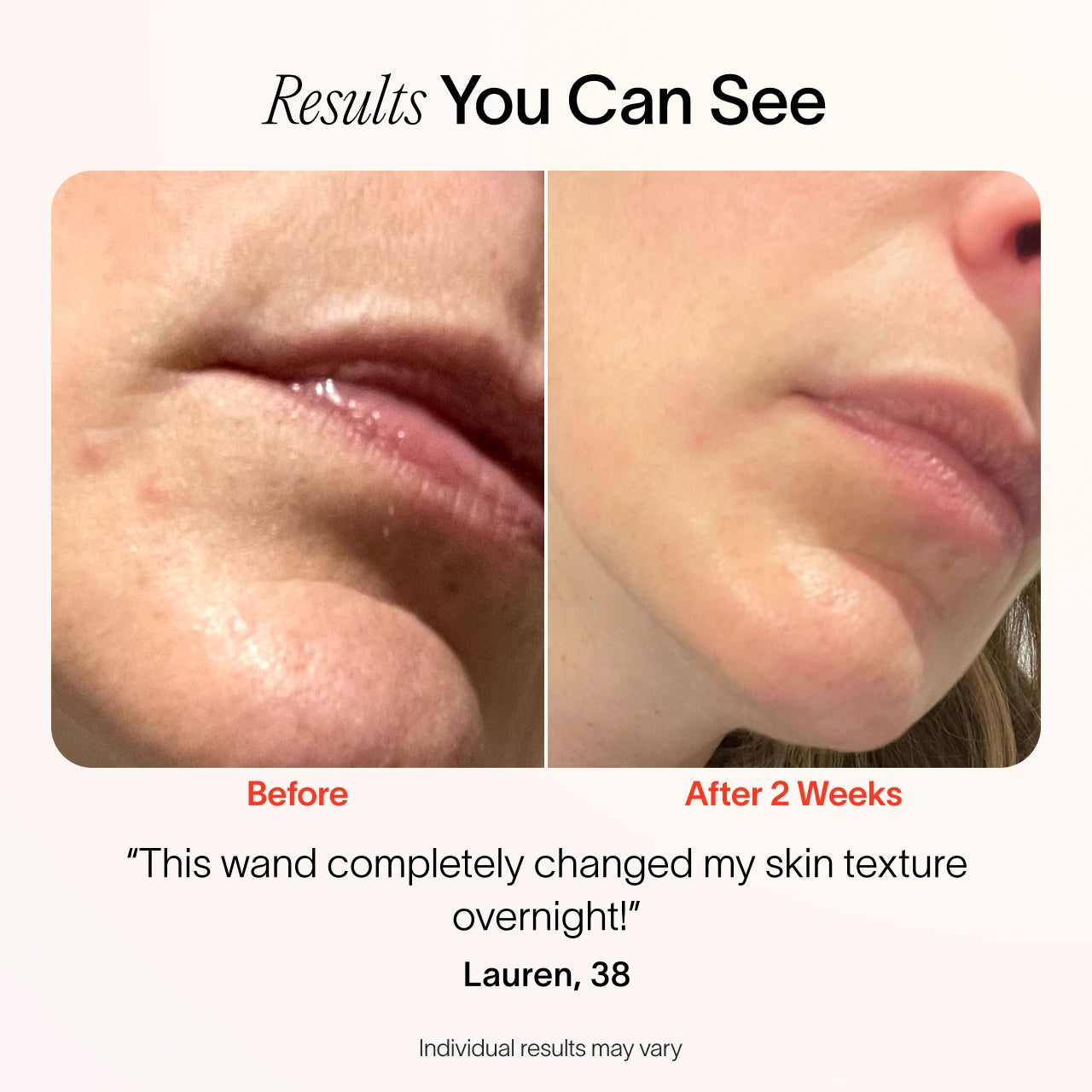 An image of red light wand before and after results || Rose Gold