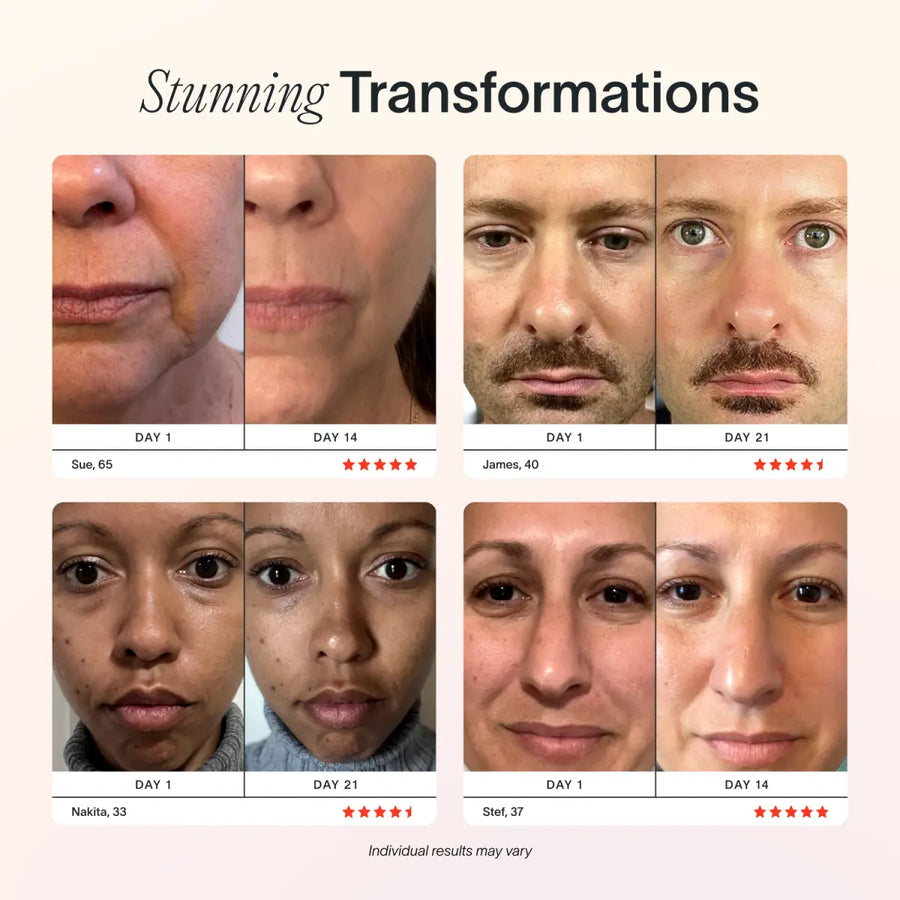 An image showing red light therapy before and after || Rose Gold