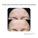 A close-up photo comparison of a persons forehead using the SolaWave 2-in-1 Face & Body Mini Starter Kit. Day 1 shows wrinkles and uneven tone, while by Day 56, theres a smoother, more even complexion. Note: Individual anti-aging results may vary. before-after