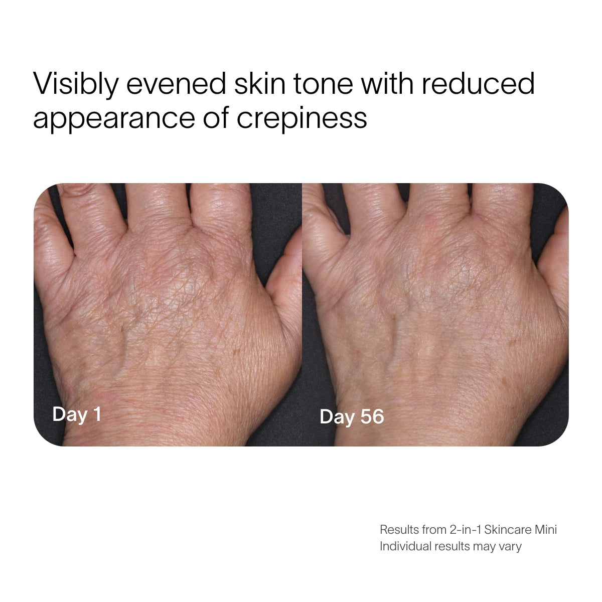 Two side-by-side images show a hand before and after using the 2-in-1 Face & Body Mini Starter Kit by SolaWave. The Day 1 image highlights crepiness, while Day 56 reveals smoother skin with improved tone, suggesting red light therapys effectiveness. before-after