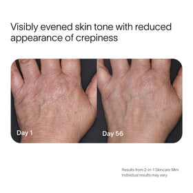 Two side-by-side images show a hand before and after using the 2-in-1 Face & Body Mini Starter Kit by SolaWave. The Day 1 image highlights crepiness, while Day 56 reveals smoother skin with improved tone, suggesting red light therapys effectiveness. before-after
