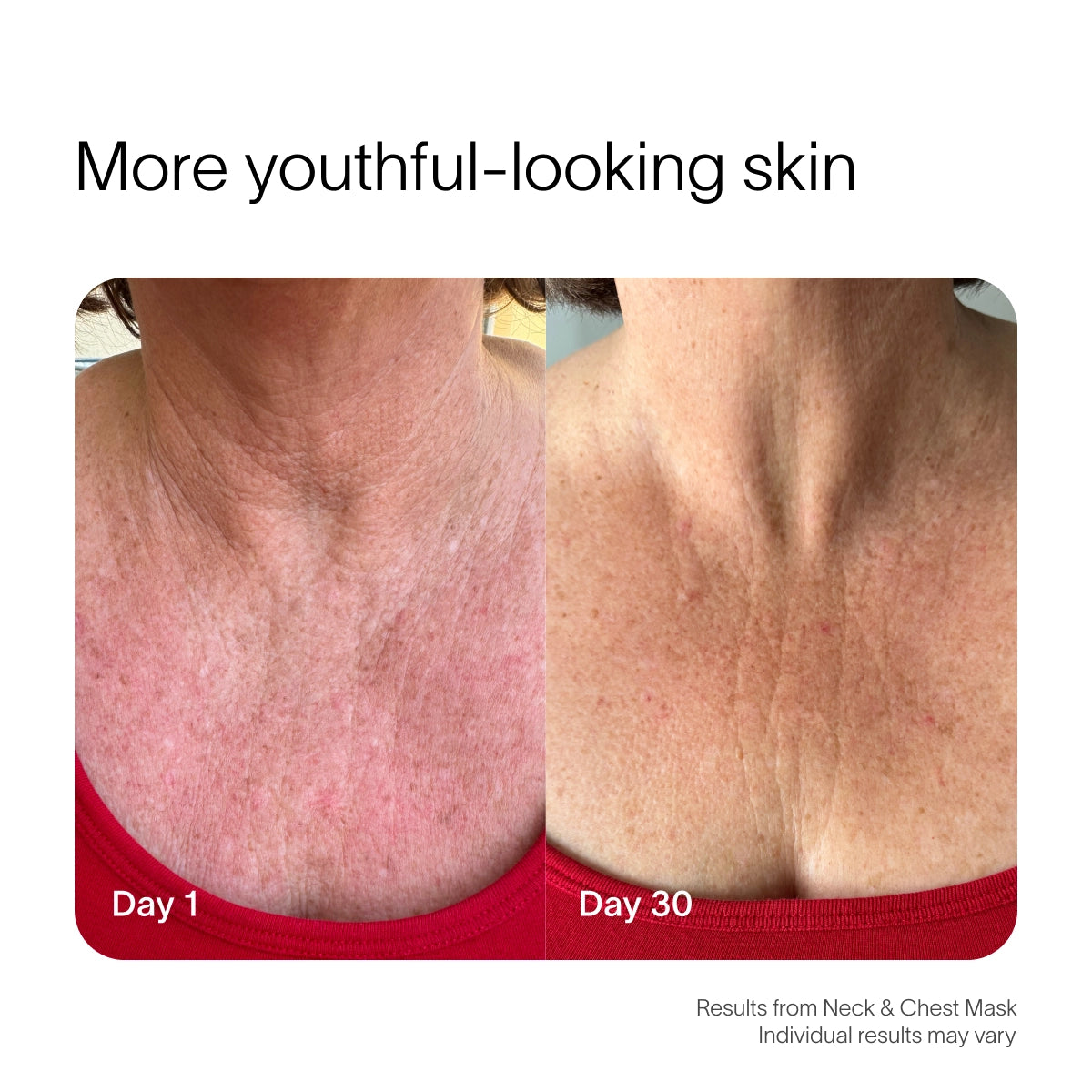 Comparison of Day 1 and Day 30 neck skin shows improved texture and appearance, featuring a person in a red top. Text reads More youthful-looking skin with Solawaves Neck & Chest LED Mask w/ LightBoost Cream Kit; individual results may vary. before-after