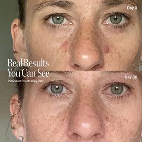 before-after