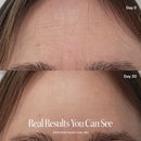 Wrinkle Retreat Pro LED Face Mask | FDA Cleared