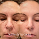 before-after ||Before and after comparison of a woman's skin after using the Solawave 4-in-1 red light therapy wand. Individual results may vary.