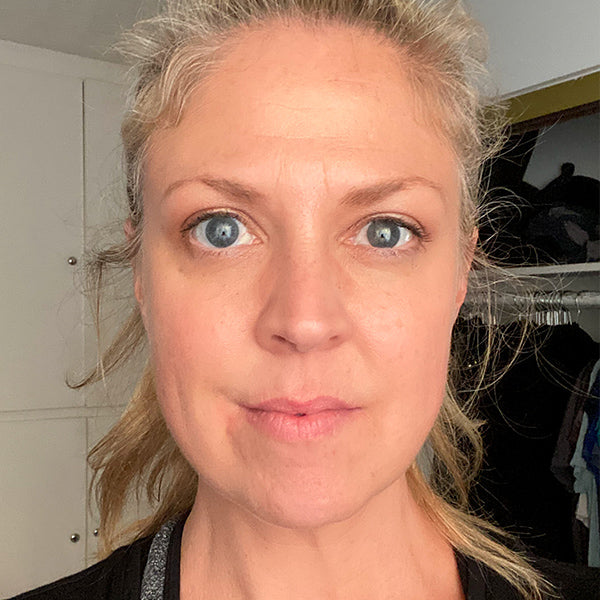 face red light therapy before and after
