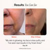 Varinha de cuidados com a pele de renovação radiante 4 em 1 com terapia de luz vermelha - preto fosco Imagem 3