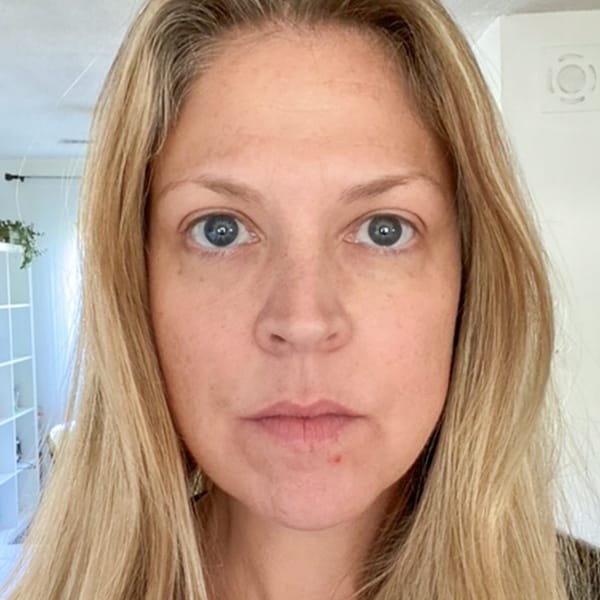 face red light therapy before and after