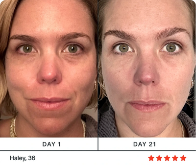 red light therapy face before and after