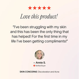 A customer review for red light therapy  || Charcoal
