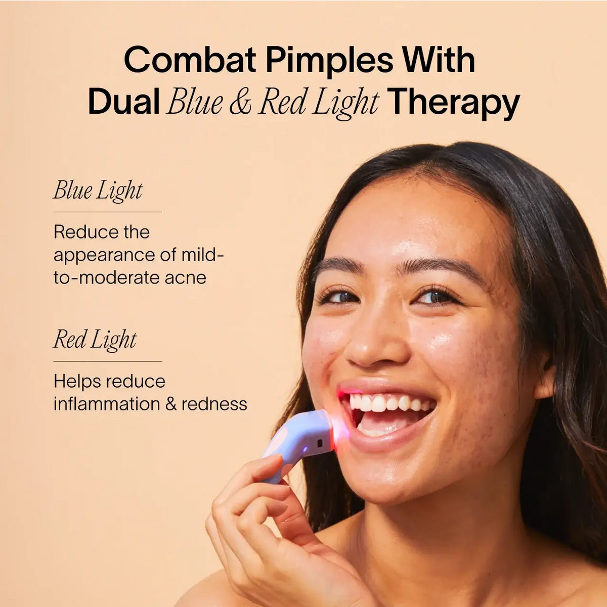 Smiling, a person uses the Bye Acne: 3-Minute Pimple Spot Treatment by SolaWave on their face. Blue light reduces mild-to-moderate acne, while red light alleviates inflammation and redness against breakouts. Beige background.|| Charcoal