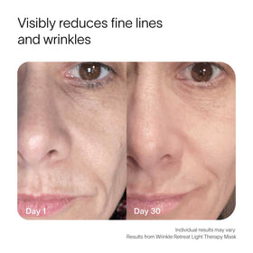 before-after