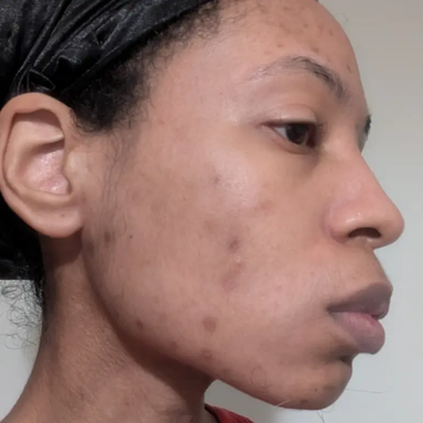 Profile on day 30
