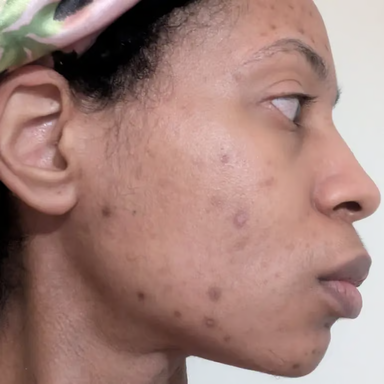 Profile on day 1
