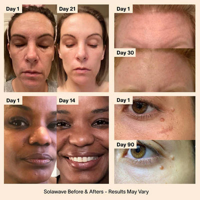 Solawave Skincare Wand Before & Afters